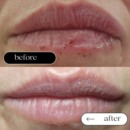 Tallow and Glow Lip Shield